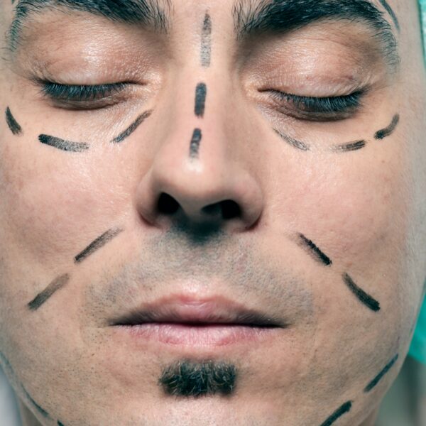 La chirurgie esthétique du visage — Clinique Esthétique Ferrère, Bordeaux
