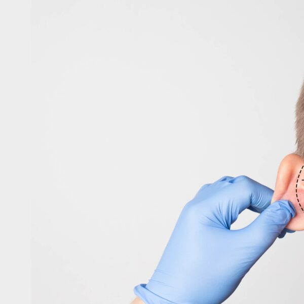 Otoplasties – Chirurgie des oreilles décollées — Clinique Esthétique Ferrère, Bordeaux