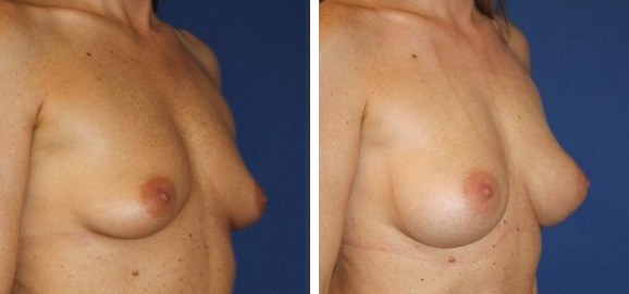 augcompo — Clinique Esthétique Ferrère, Bordeaux